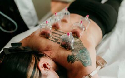 Cupping therapy near Bushnell, Florida
