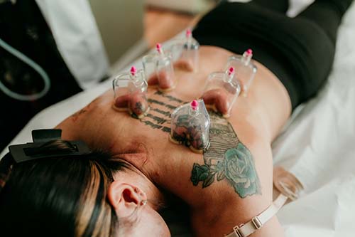 Cupping Therapy Bushnell Florida