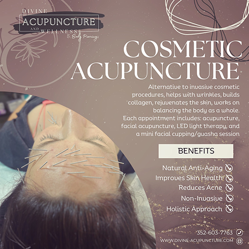 The Benefits of Cosmetic Acupuncture